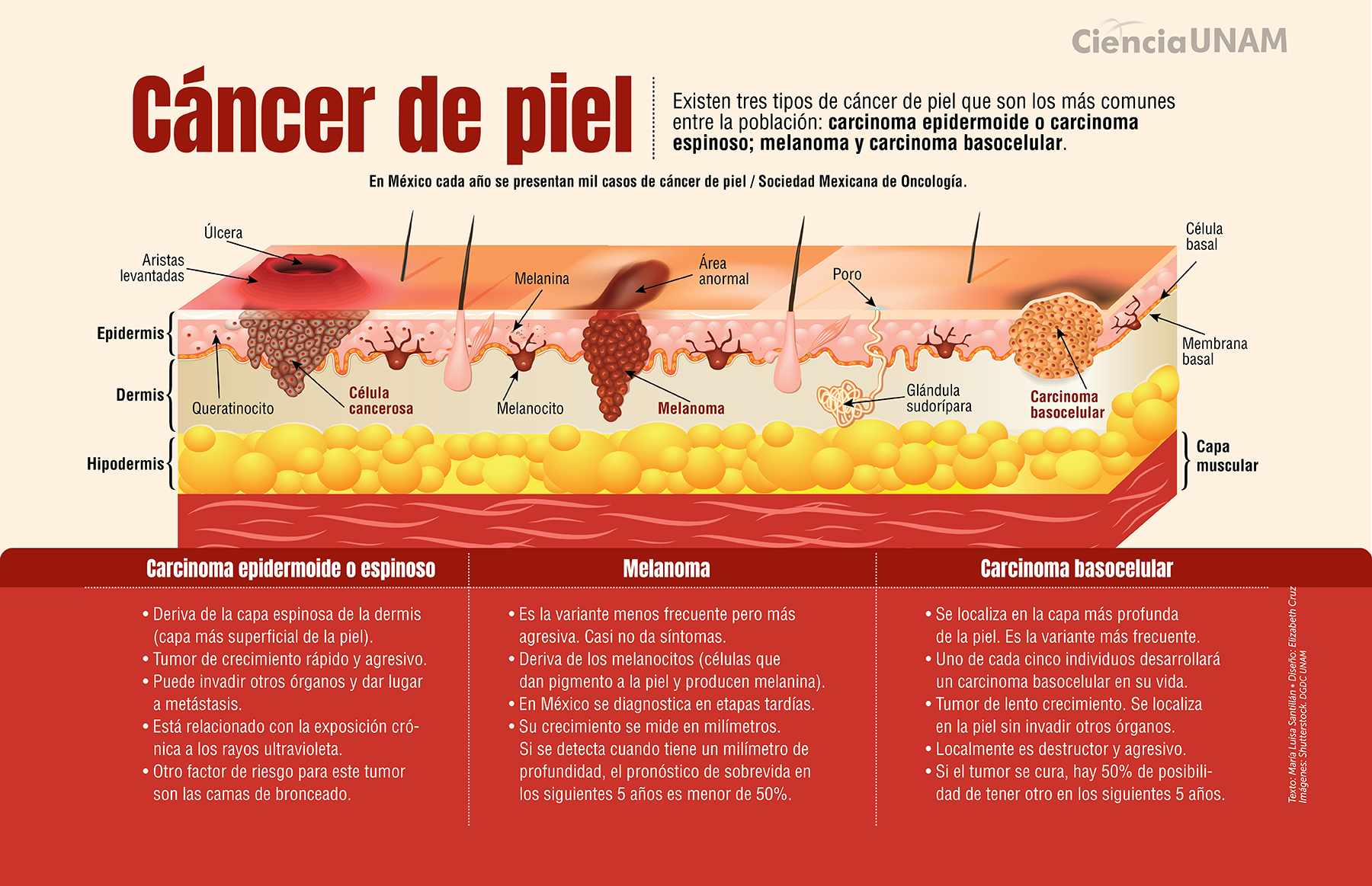 Infografía ¡cuídate Del Cáncer De Piel Ciencia Unam